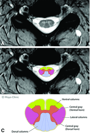 FIG 2.