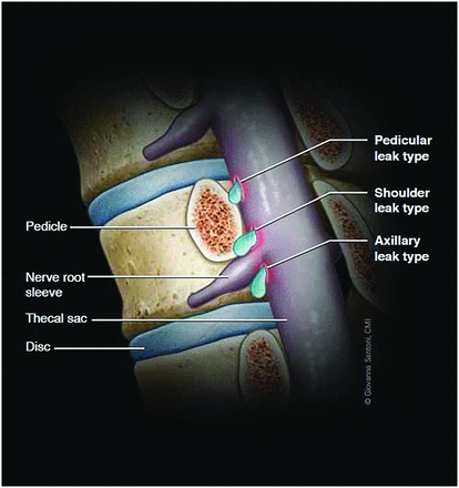 FIG 1.