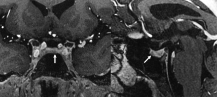 FIG 2.