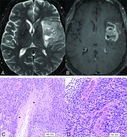 FIG 3.
