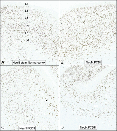 FIG 4.