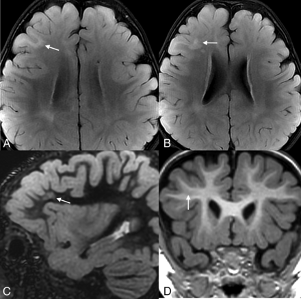 FIG 7.