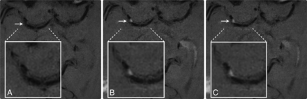 FIG 2.