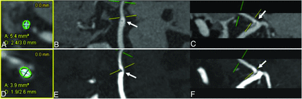 FIG 1.