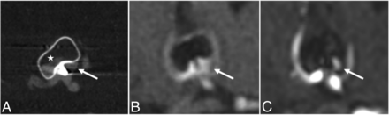 FIG 2.