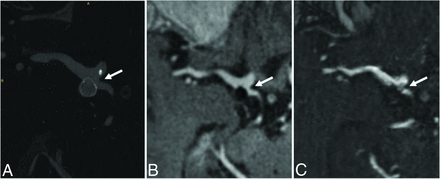 FIG 3.
