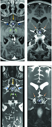 FIG 2.