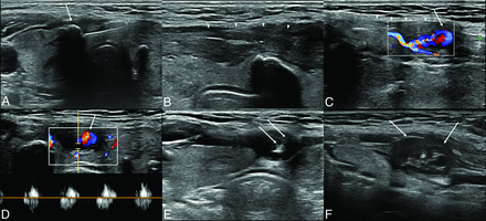 FIG 2.