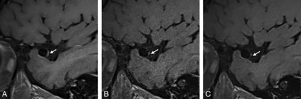 FIG 3.