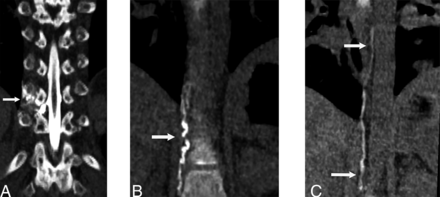 FIG 3.