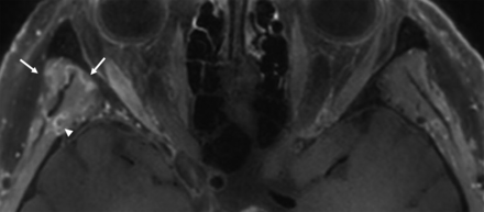 FIG 10.