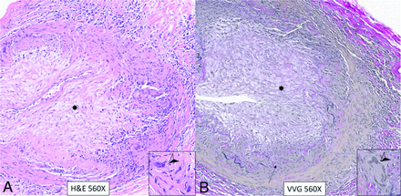 FIG 1.