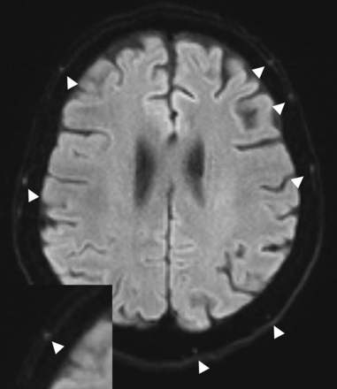 FIG 4.