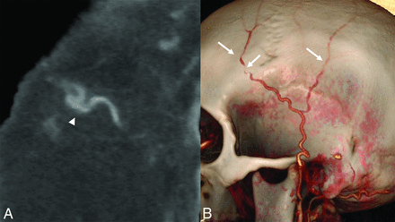 FIG 7.