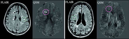 FIG 1.