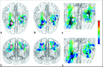 FIG 3.