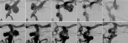 FIG 3.