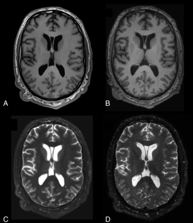 FIG 2.
