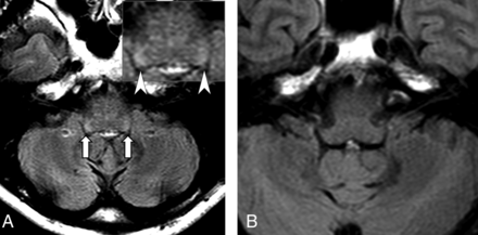 FIG 2.
