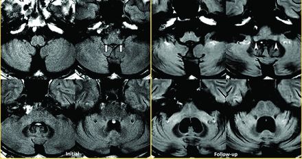 FIG 3.
