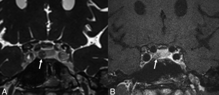 FIG 1.