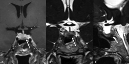 FIG 3.