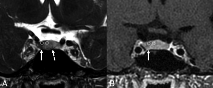 FIG 4.