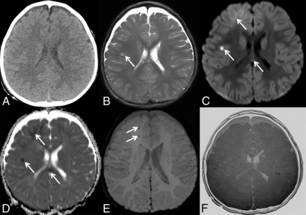 Fig 3.