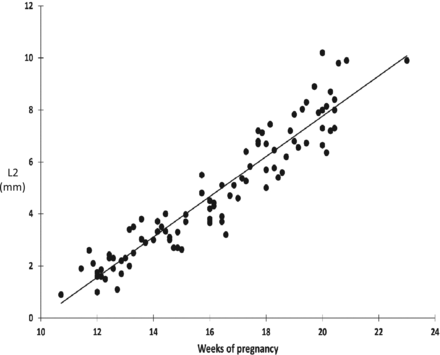 Fig 11.