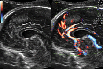 Fig 13.