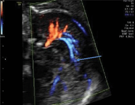 Fig 5.