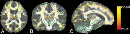 Fig 4.