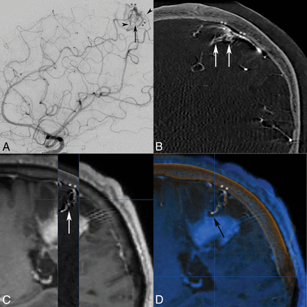 Fig 3.