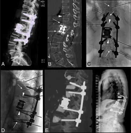 Fig 3.