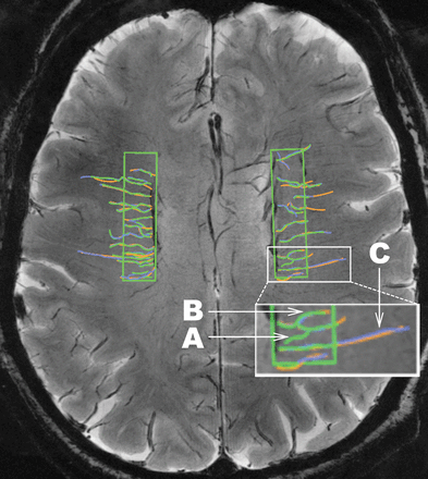 Fig 1.