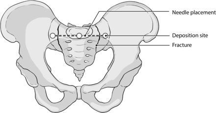 Fig 7.