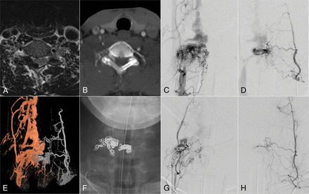 Fig 3.