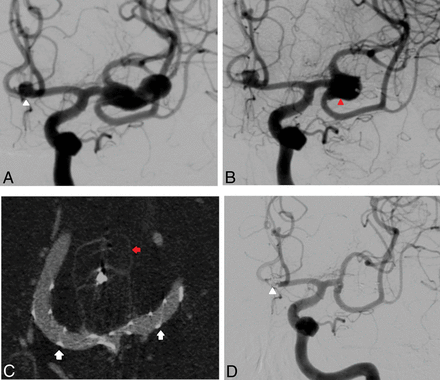 Fig 3.
