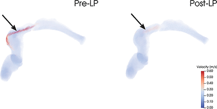 Fig 3.