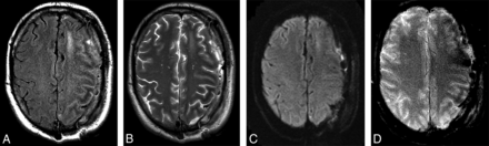 Fig 1.