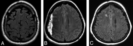 Fig 3.