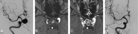 FIG 2.