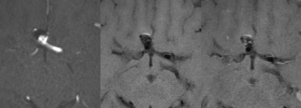 FIG 4.