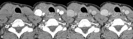 FIG 1.