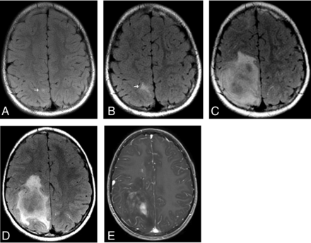 FIG 2.