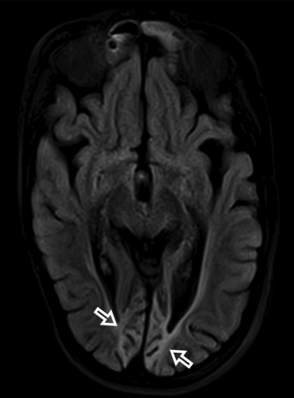 FIG 4.