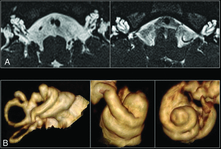 FIG 1.