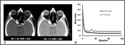 FIG 3.