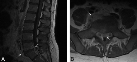 FIG 3.