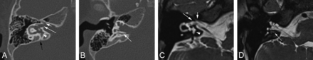 FIG 2.